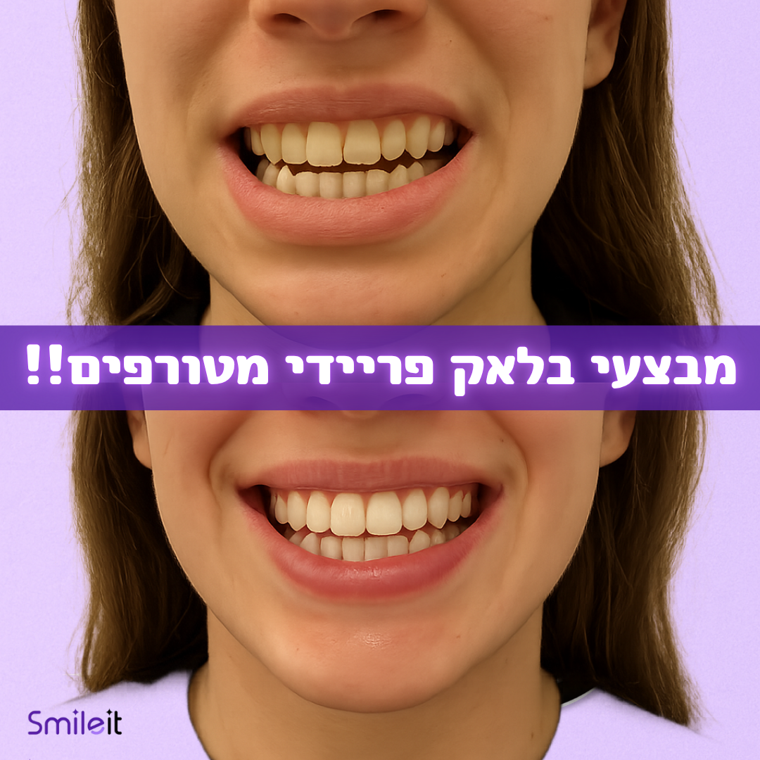 פורמולת ההלבנה האינטסיבית של סמיילית